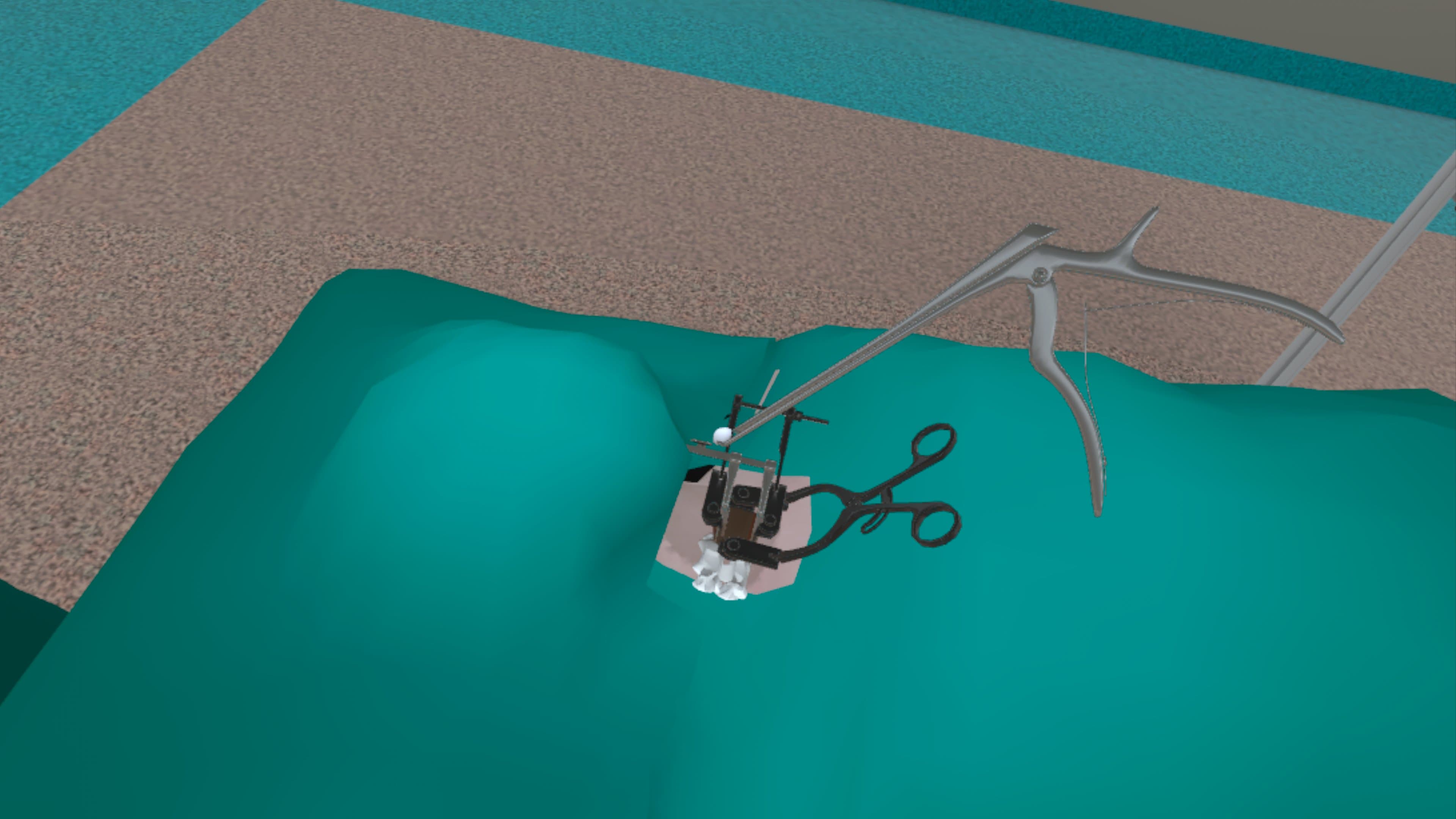 ACDF – přední meziobratlová fúze